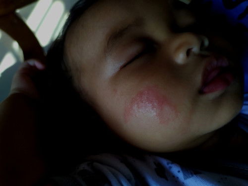 pipi merah