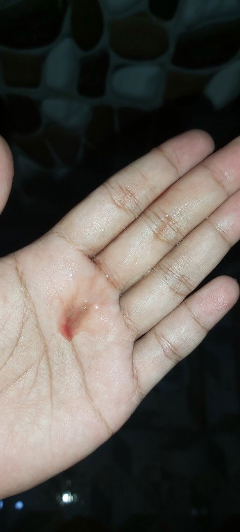 Keluar lendir campur darah