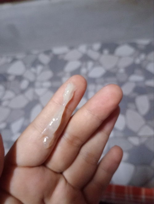 อยากทราบว่าแบบนี้คือมูกใสหรือตกขาว