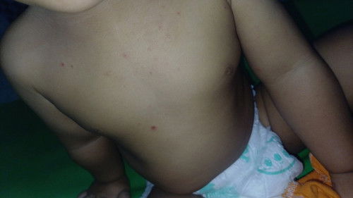 Bintik merah kering