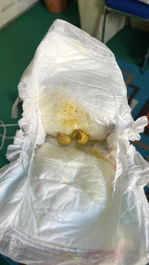 Apakah anak saya sembelit?