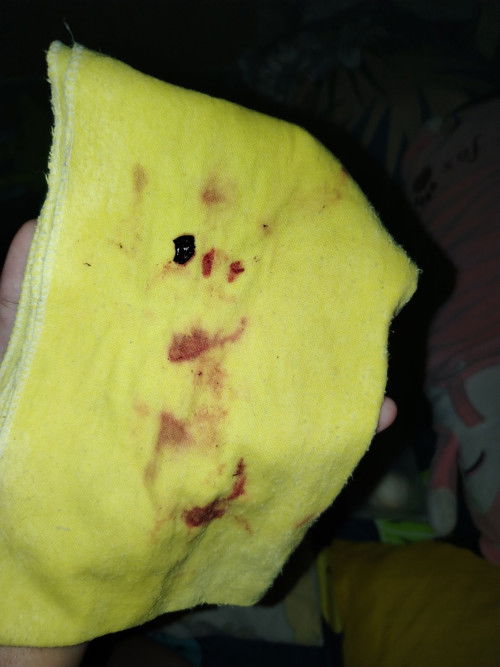 Asking for help. Need OB here.