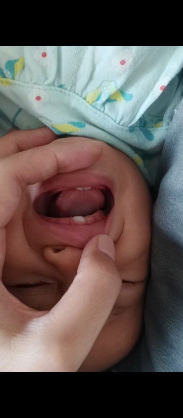 Normal ke gigi bayi tumbuh tak ikut turutan?