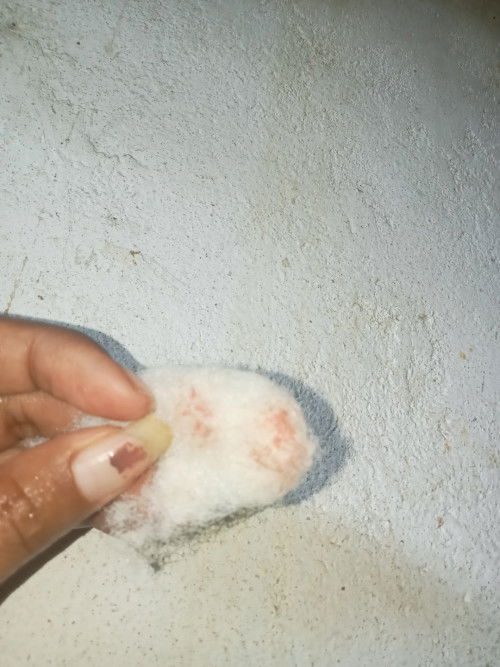 Apakah ini flek haid atau hamil?