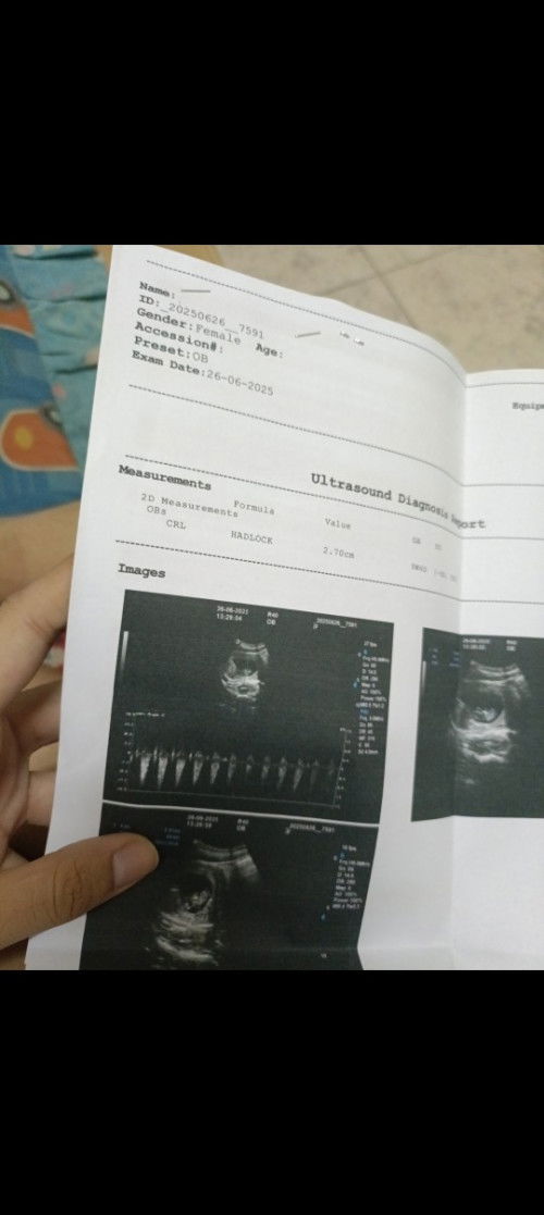 หัวใจลูกเต้นยังคะ