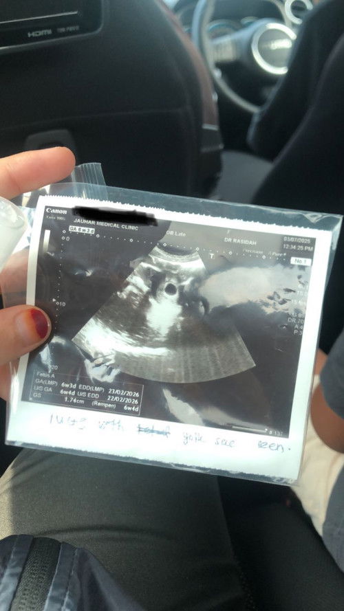 hi semua nak tanye 6weeks selalunya akan nampak kantung saja and just ada janin kecik je ke