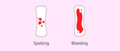 spotting means what?