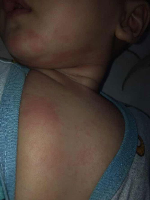 Awal MPASI/ masa mpasi