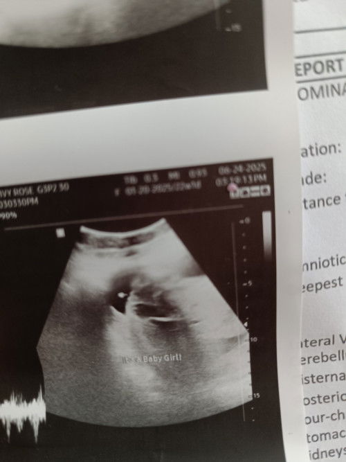 Boy or Girl