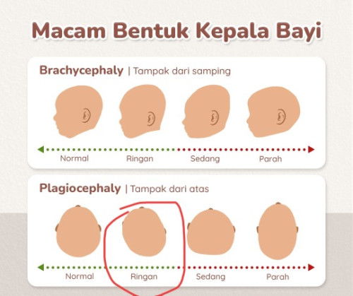 Bantal yg sesuai utk betulkan position tidur baby 3m