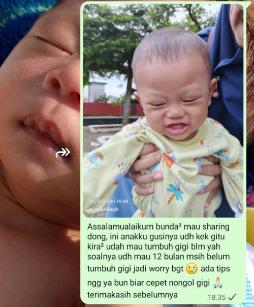 Tips agar cepet tumbuh gigi