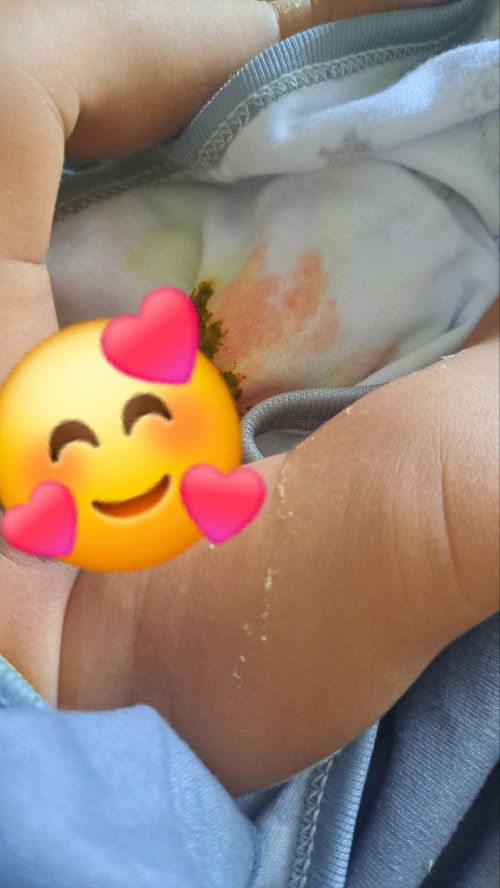 Anak bayi usia baru seminggu