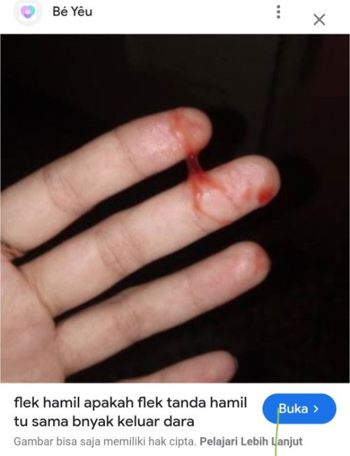 Keluar flek lendir bercampur darah..