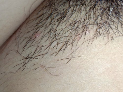 Private part