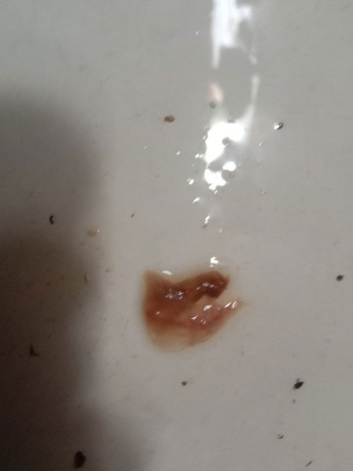 hamil 40mg keluar flek