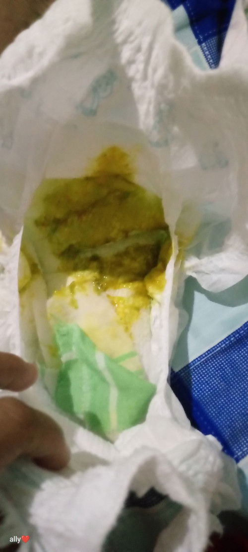 Hello Po normal lang Po ba sa baby mag poop Ng kulay green tuwing nagpapatubo Ng ngipin??