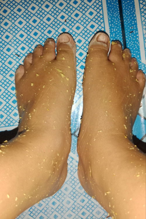 Kaki bengkak di 35week