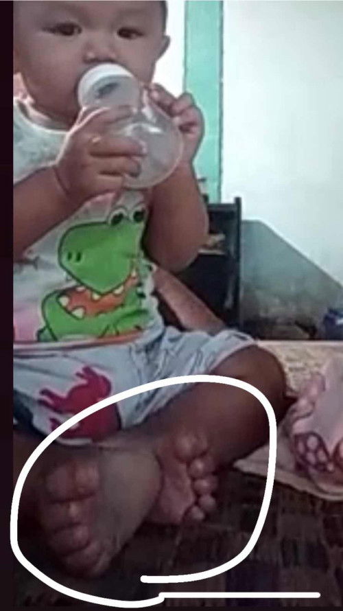 ขอสอบถามแม่ๆค่ะ