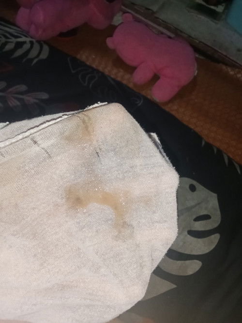 Asalamualaikum mau tanya dong klo flek kya gini keguguran apa cuma plek biasa ya maklum bru pertama
