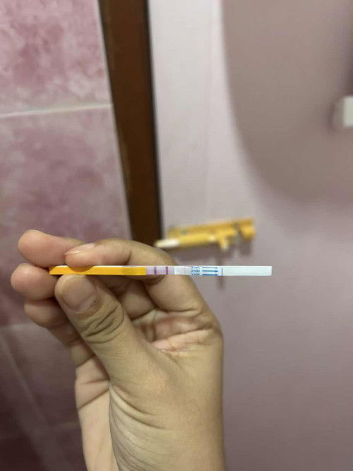 Opk +ve upt -ve