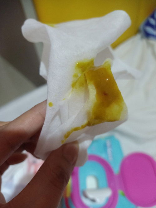 Blood s poop