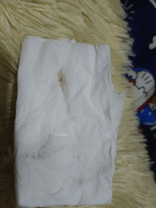 Flek coklat samar