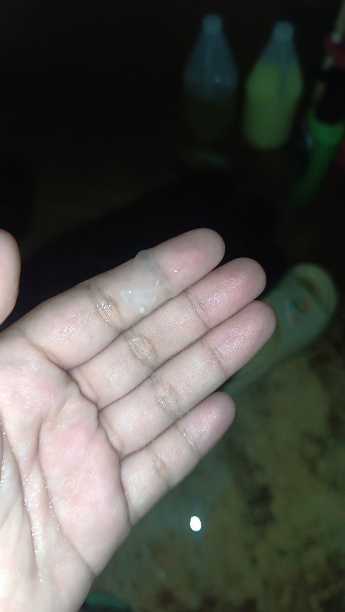 แบบนี้เป็นอะไรไหมคะ 31+5 มีอันนี้ออกมาตอนอาบนํ้า ไม่มีอาการปวดท้องรึอะไรเลยปกติทุกอย่าง