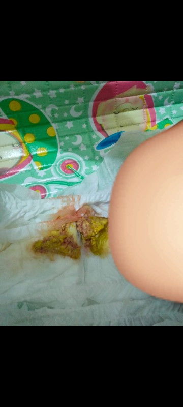 Maaf bunda jorok,
Bun mau tanya dong, ini fases bayiku ada warna coklat gini,