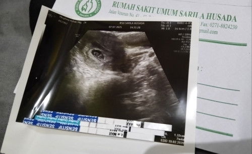 Hasil usg 7w4d kata bidan cuma kantong aja,tpi dari dokter bilang udah keliatan janinnya