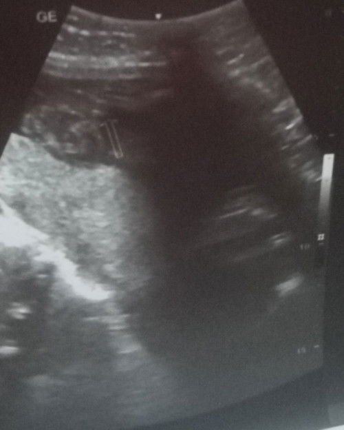 Hello po mga momshie tanong Lang po ako. ano sa Tingin nyo Gender n baby?
