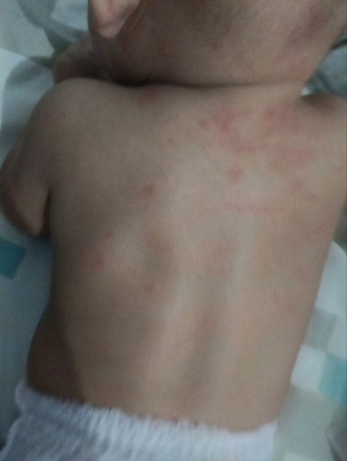 Hello, mums. Siapa ada pengalaman anak begini? Ini apa ya. Pandai hilang, Pandai timbul.