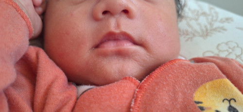 Kulit bayi kasar