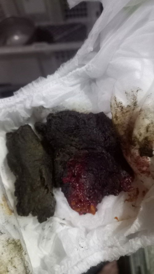 Warna bab pada balita 19 bulan
