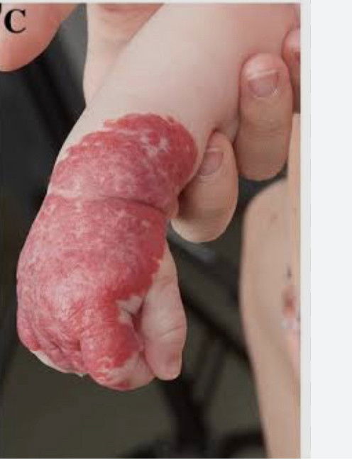 Skin red patch