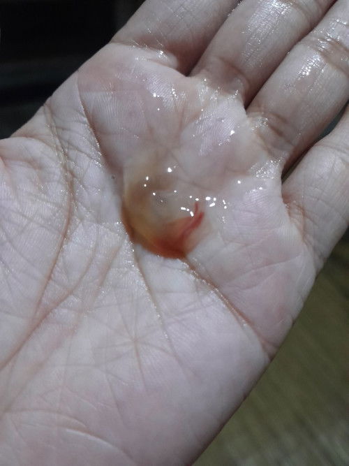 Maaf jorok bun🙏 lendir campur darah tanpa ada nya kontraksi apakah tanda mau melahirkan??