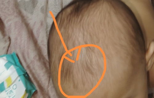 kepala baby