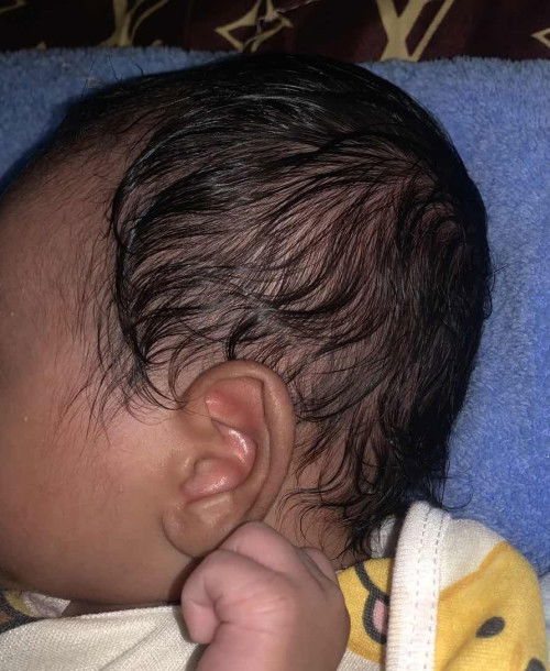 เเบบนี้หัวลูกแบนมั้ยคะเเม่ๆ