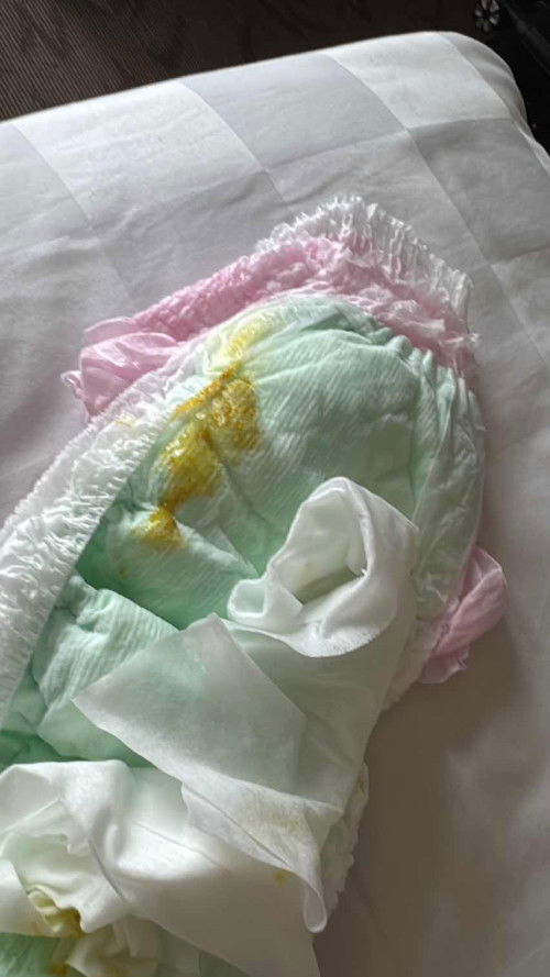 Diare Bayi 9 bulan 16 hari