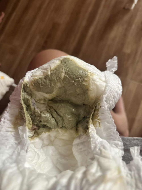 เป็นแม่มือใหม่ค่ะช่วยบอกทีนะคะ
