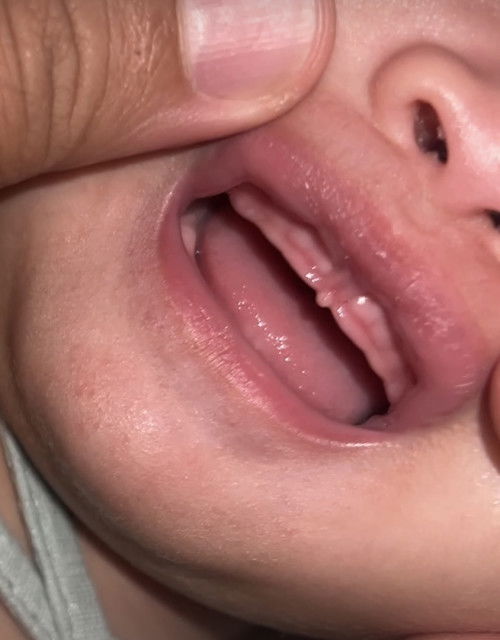Teething ke?