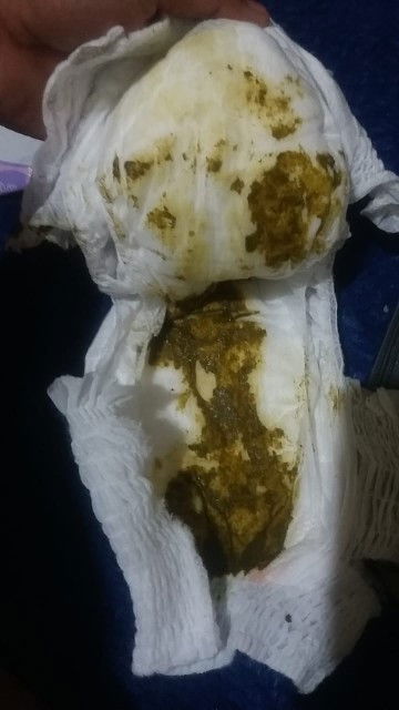 Bab bayi hijau