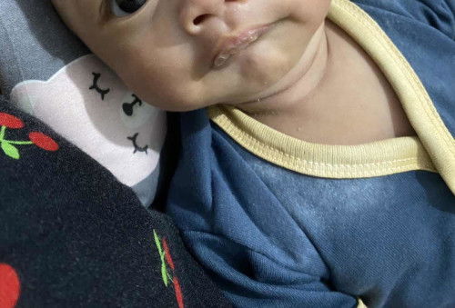 Bibir bayi kering atas aja
