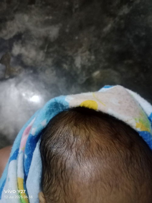 Kenapa kepala bayi saya ada benjolan?