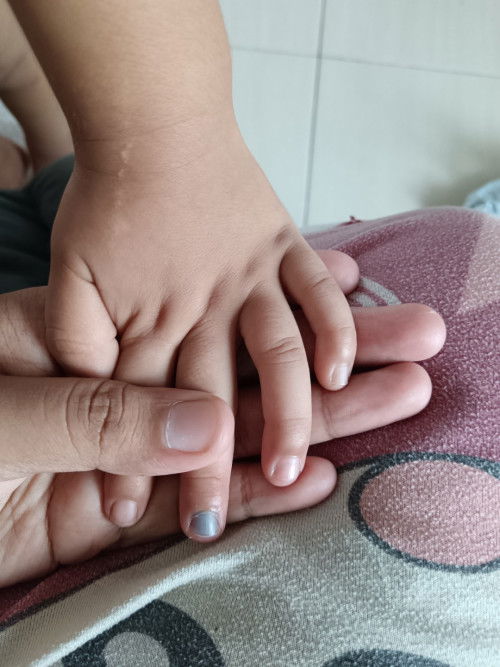 Jari anak tersepit