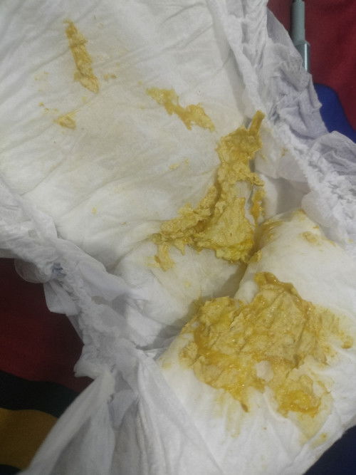 Pup berlendir ada ampasnya
