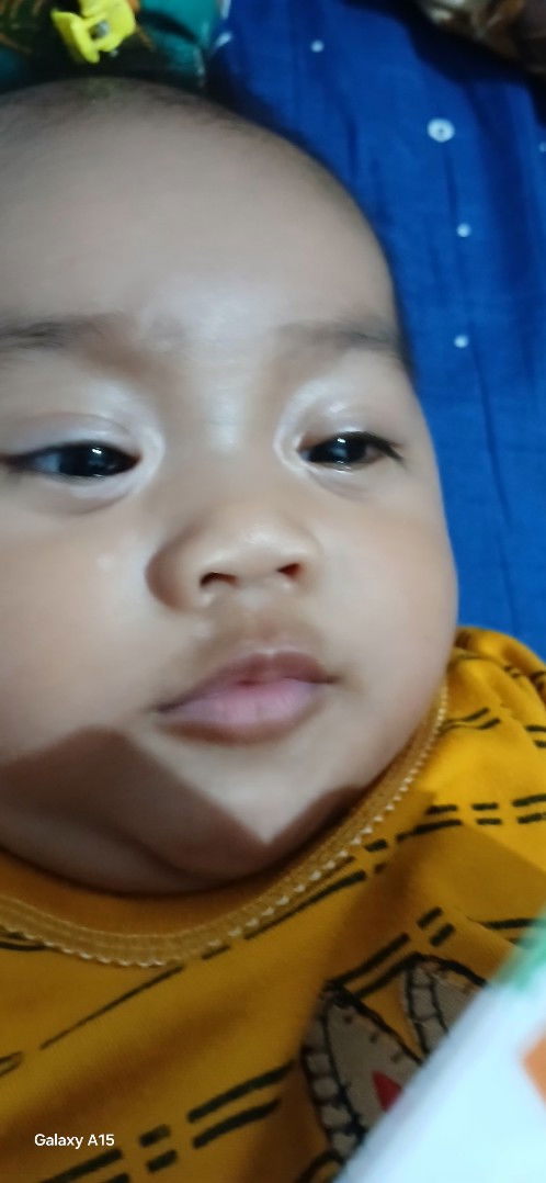 Putihw dimata, pipi, dan bawah hidung..