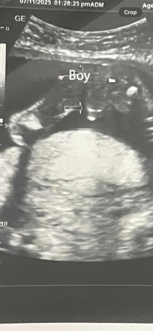 20 weeks & 3 days ITS A BOY