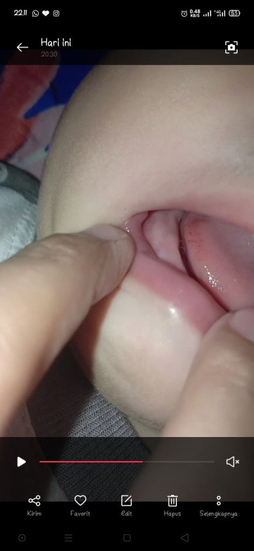 Sariawan Panas Dalam?