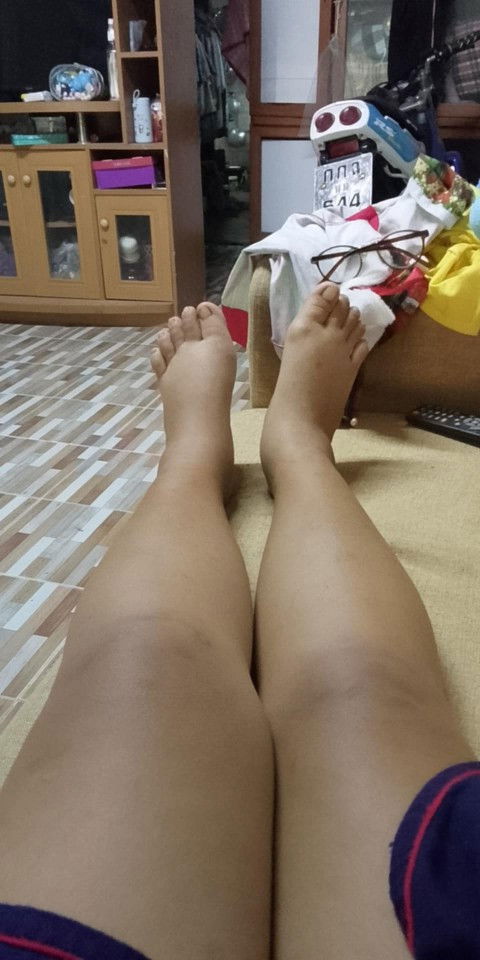 เท้าบวมแบบนี้ปกติมั้ย