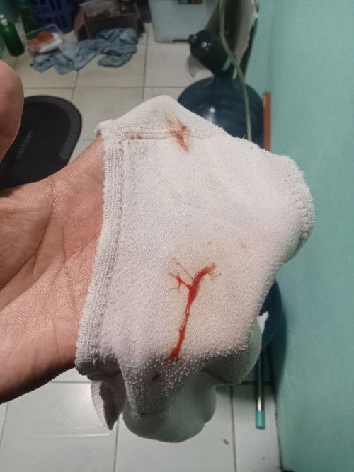 Ijin tanya Bun, aku hpht 15 mei. Keluar lendir seperti itu bahaya ga ya bund?